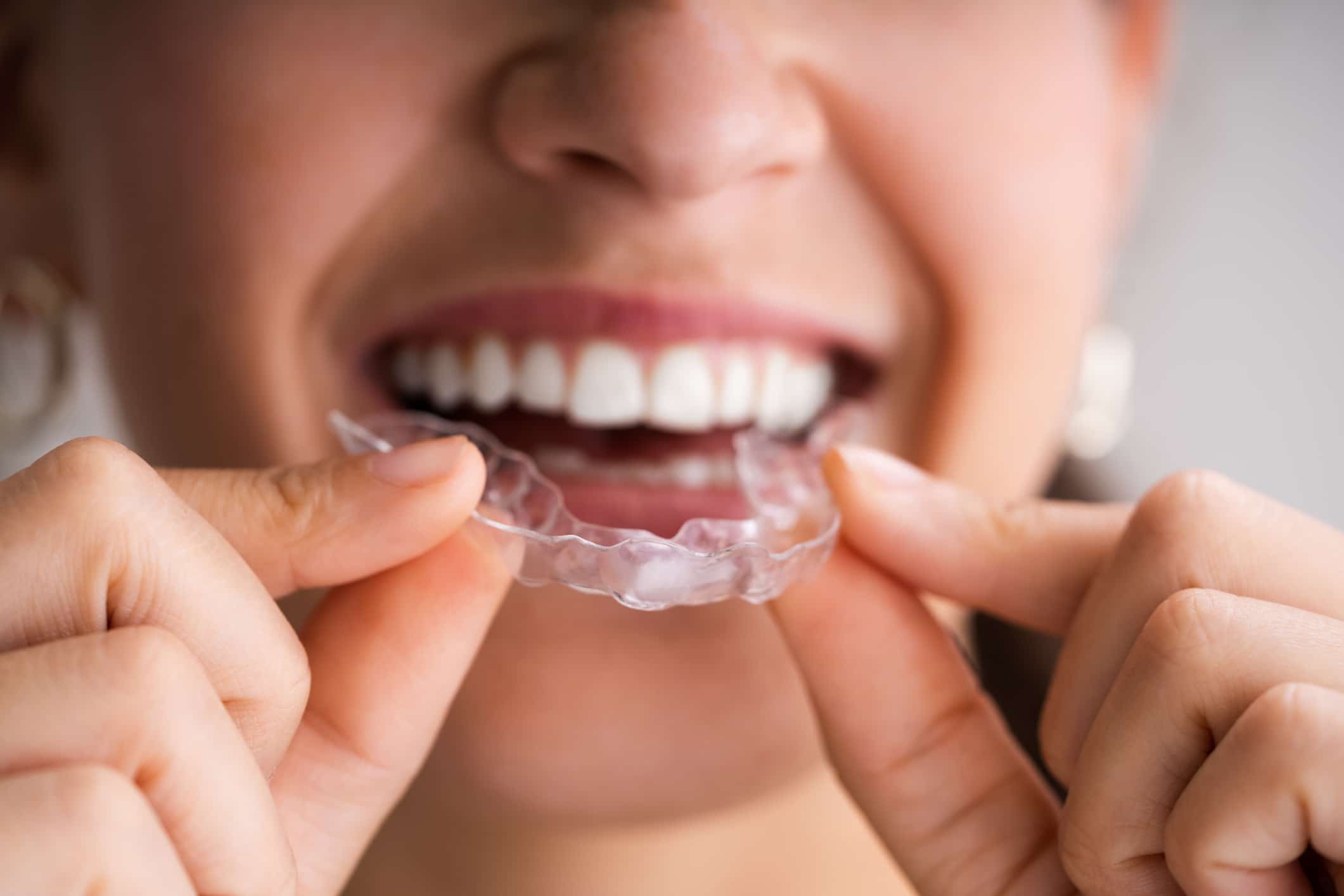 Clear Aligner Dental Night Guard