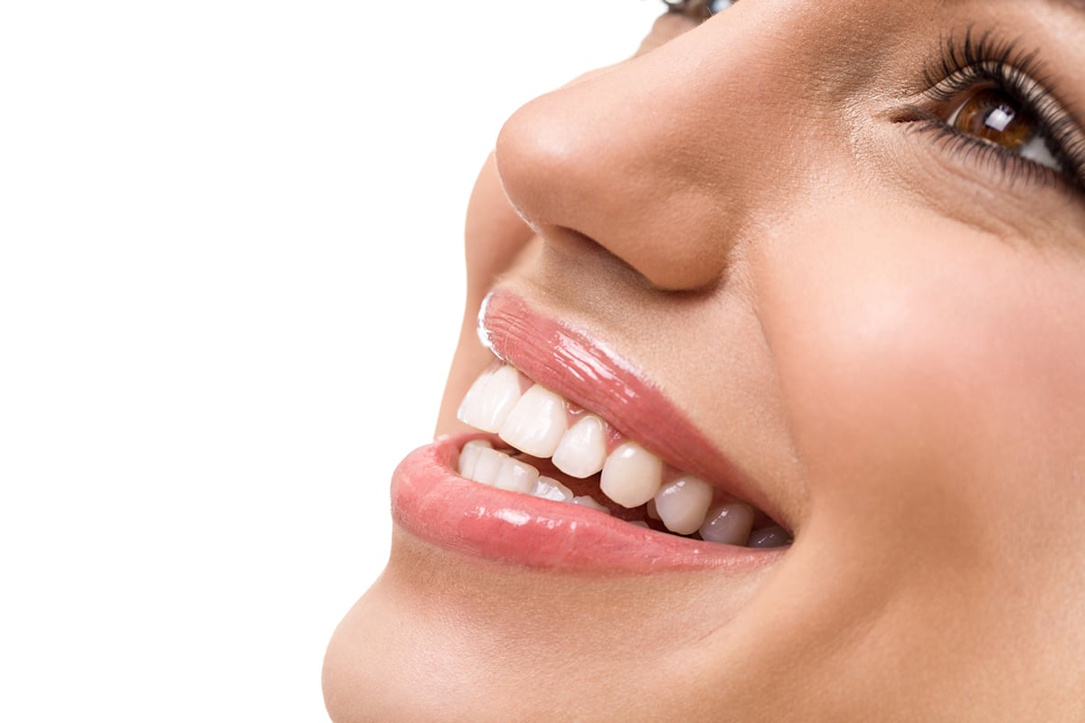 How Do Dental Veneers Work Blog